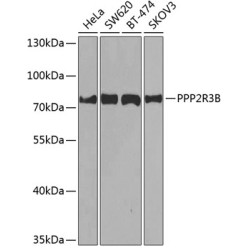 PPP2R3B Rabbit pAb