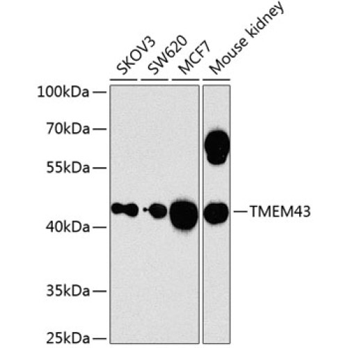 TMEM43 Rabbit pAb