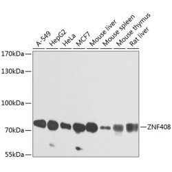 ZNF408 Rabbit pAb