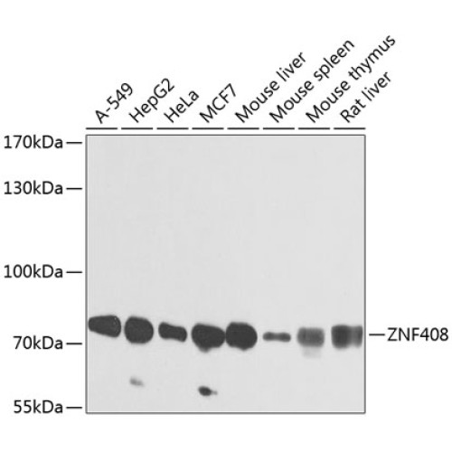 ZNF408 Rabbit pAb
