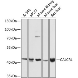 CALCRL Rabbit pAb