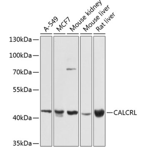 CALCRL Rabbit pAb