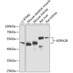 ADRA2B Rabbit pAb