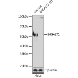 [KO Validated] B4GALT1 Rabbit pAb