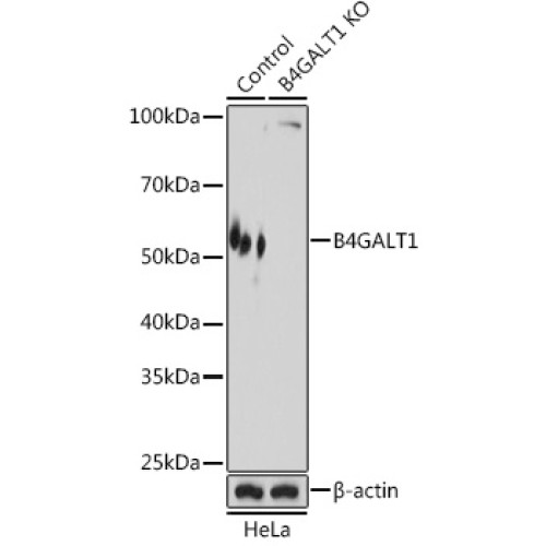 [KO Validated] B4GALT1 Rabbit pAb