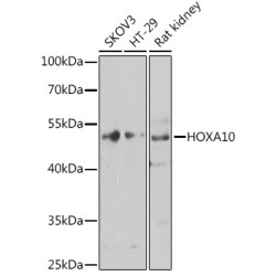 HOXA10 Rabbit pAb