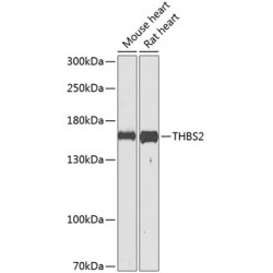THBS2 Rabbit pAb