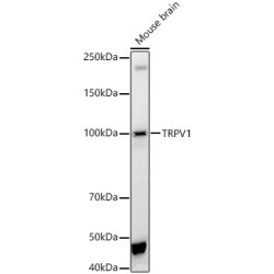 TRPV1 Rabbit pAb