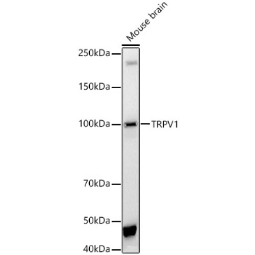 TRPV1 Rabbit pAb
