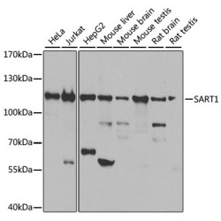 SART1 Rabbit pAb