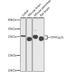 TPPP/p25 Rabbit pAb