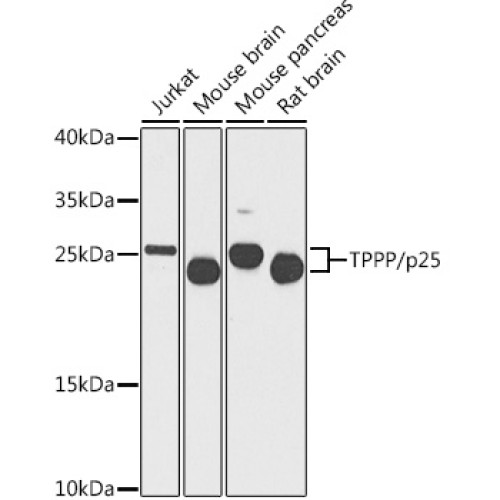 TPPP/p25 Rabbit pAb
