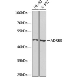 ADRB3 Rabbit pAb