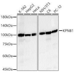 KPNB1 Rabbit pAb