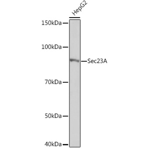 Sec23A Rabbit mAb