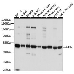 [KO Validated] GDI2 Rabbit pAb