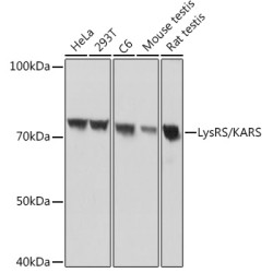 LysRS/KARS Rabbit mAb