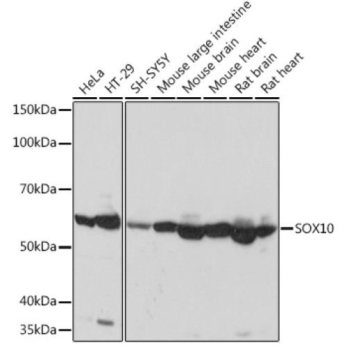 SOX10 Rabbit mAb