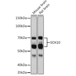 SOX10 Rabbit mAb