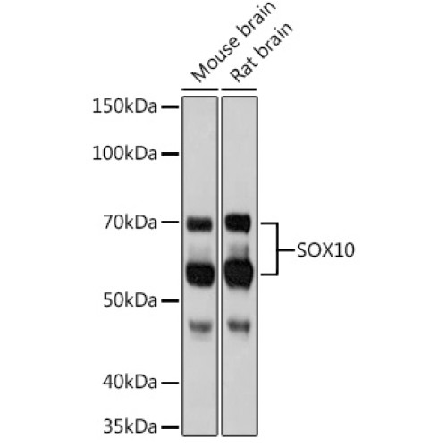 SOX10 Rabbit mAb