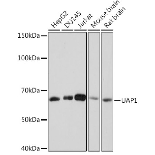 UAP1 Rabbit mAb