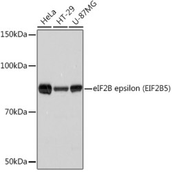 eIF2B epsilon (EIF2B5) Rabbit mAb