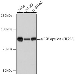 eIF2B epsilon (EIF2B5) Rabbit mAb