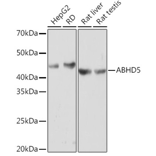 ABHD5 Rabbit mAb