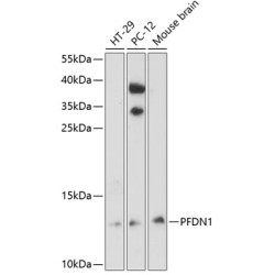 PFDN1 Rabbit pAb