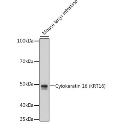 Cytokeratin 16 (KRT16) Rabbit mAb