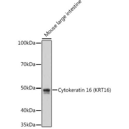 Cytokeratin 16 (KRT16) Rabbit mAb