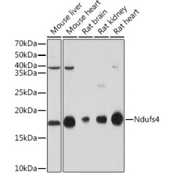 NDUFS4 Rabbit mAb