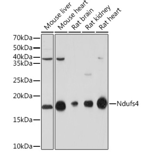 NDUFS4 Rabbit mAb