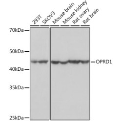 OPRD1 Rabbit mAb