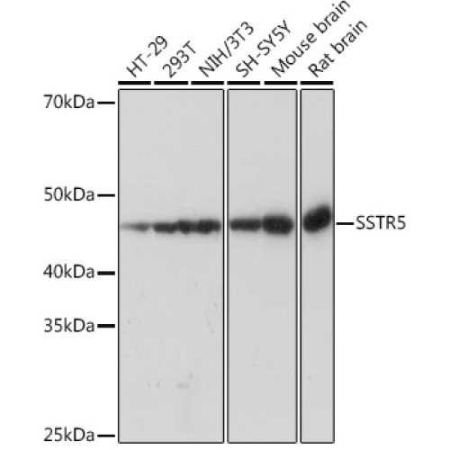 SSTR5 Rabbit mAb