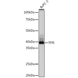 TFPI Rabbit mAb
