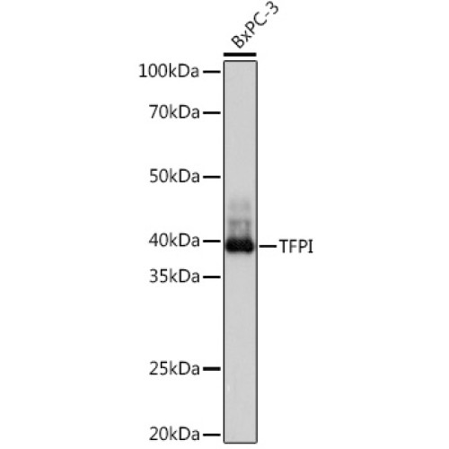 TFPI Rabbit mAb