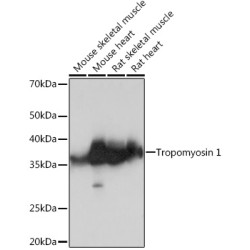 Tropomyosin 1 Rabbit mAb