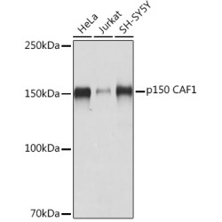 p150 CAF1 Rabbit mAb
