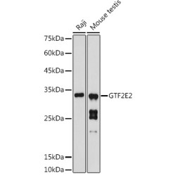 GTF2E2 Rabbit pAb