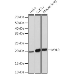 MYL9 Rabbit mAb
