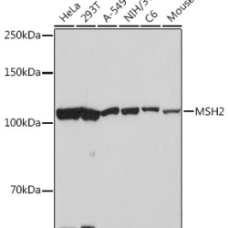 MSH2 Rabbit mAb