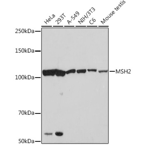 MSH2 Rabbit mAb