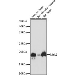 MYL2 Rabbit mAb
