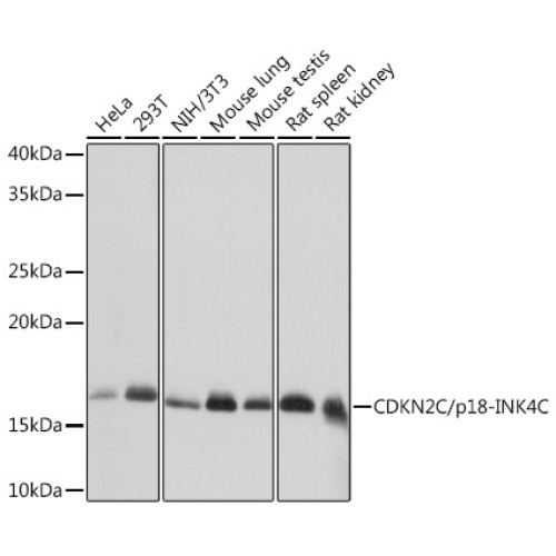[KD Validated] CDKN2C/p18-INK4C Rabbit mAb