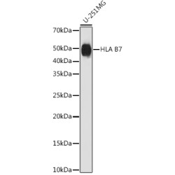 HLA B7 Rabbit mAb