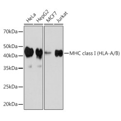 MHC class I (HLA-A/B) Rabbit mAb