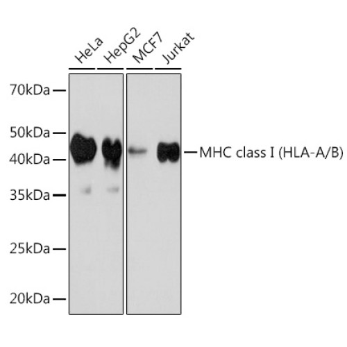MHC class I (HLA-A/B) Rabbit mAb