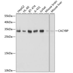 [KO Validated] CACYBP Rabbit pAb