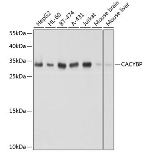 [KO Validated] CACYBP Rabbit pAb